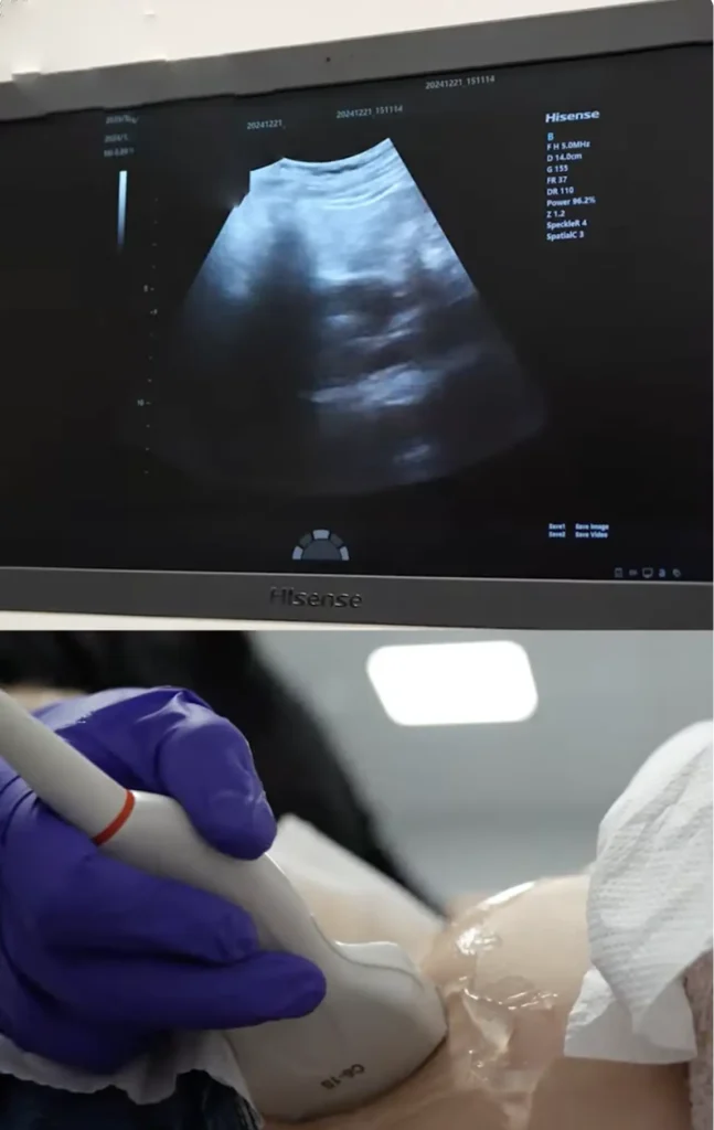 HiUltrasound i Fundacja Mocni na Starcie - kadr z materiału wideo