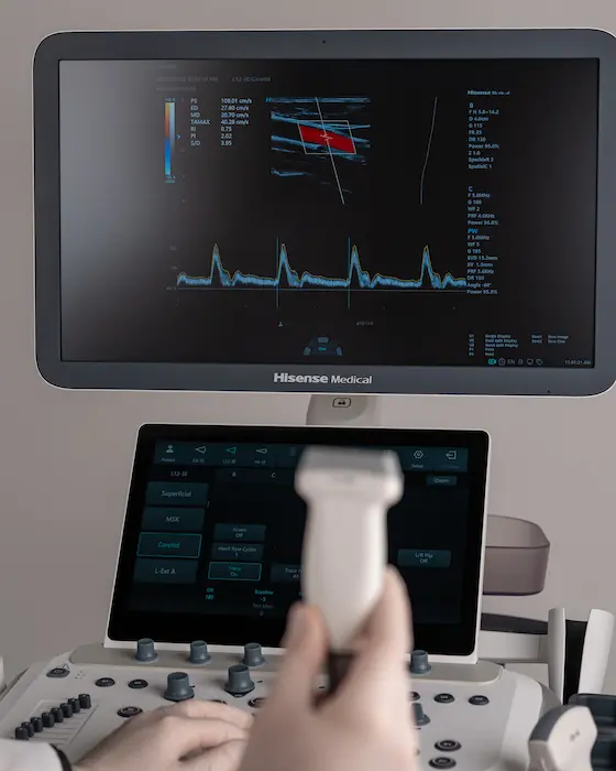 Badanie ultrasonograficzne aparatem Hisense - głowica w dłoni operatora