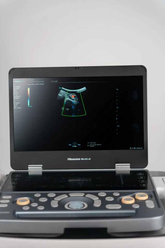 Aisense E50 - mobilny aparat ultrasonograficzny
